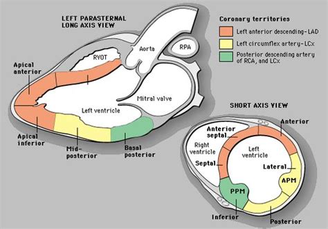 hypokinesis of basal inferior wall.